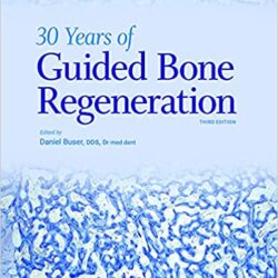 30 Years of Guided Bone Regeneration in Implant Dentistry 3rd Edition Third ed