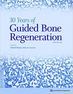 30 Years of Guided Bone Regeneration in Implant Dentistry 3rd Edition