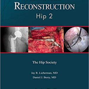 AAOS Advanced Reconstruction: Hip-Two (2e/2nd ed) ( American Academy of Orthopaedic Surgeons) Second Edition