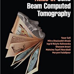 Atlas of Cone Beam Computed Tomography 1st Edition-ORIGINAL PDF