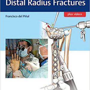 Atlas of Distal Radius Fractures (First ed/1e) 1st Edition