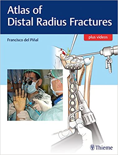 Atlas of Distal Radius Fractures 1st Edition