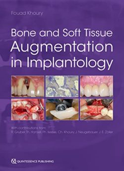 Bone and Soft Tissue Augmentation in Implantology 1st Edition