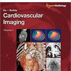 Cardiovascular Imaging, 2-Volume Set: Expert Radiology Series, [first ed] 1st Edition