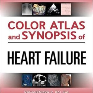 Color Atlas and Synopsis of Heart Failure 1st Edition