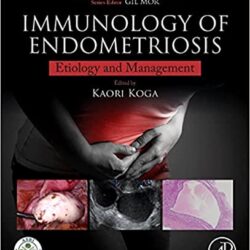 Immunology of Endometriosis: Pathogenesis and Management1st Edition