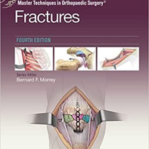 Master Techniques in Orthopaedic Surgery: Fractures (4th ed/4e) Fourth Edition