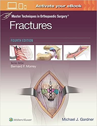 Master Techniques in Orthopaedic Surgery: Fractures (4th ed/4e) Fourth Edition