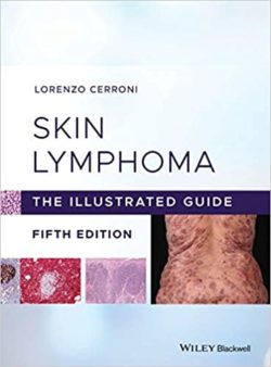 Skin Lymphoma: The Illustrated Guide 5th Edition