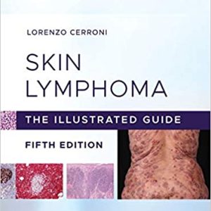 Skin Lymphoma: The Illustrated Guide 5th Edition ✓
