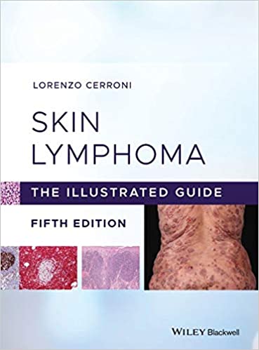 سرطان الغدد الليمفاوية الجلدية: الدليل المصور الطبعة الخامسة ✓