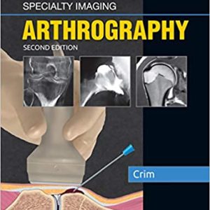 Specialty Imaging: Arthrography (2nd ed/2e) Second Edition