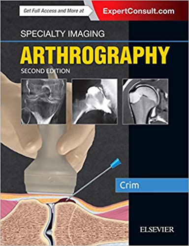 Specialty Imaging: Arthrography (2nd ed/2e) Second Edition