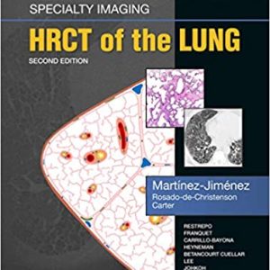 Specialty Imaging: HRCT of the Lung (2nd ed/2e) Second Edition