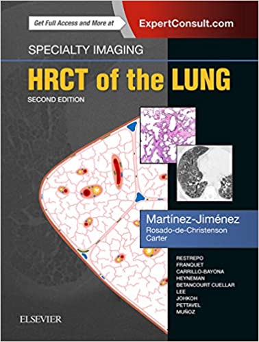 Specialty Imaging: HRCT of the Lung (2nd ed/2e) Second Edition