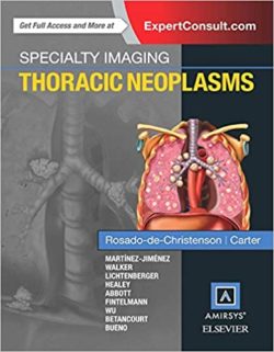 Specialty Imaging: Thoracic Neoplasms (1st ed/1e) First Edition