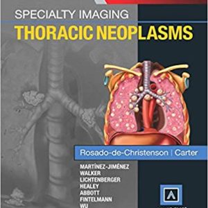 Specialty Imaging: Thoracic Neoplasms (1st ed/1e) First Edition