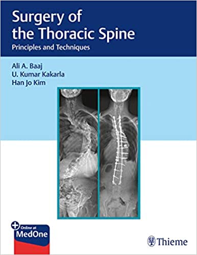 Surgery of the Thoracic Spine: Principles and Techniques 1st Edition