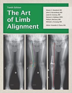 The Art of Limb Alignment 10th ed  Tenth Edition