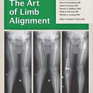 The Art of Limb Alignment 10th ed Tenth Edition