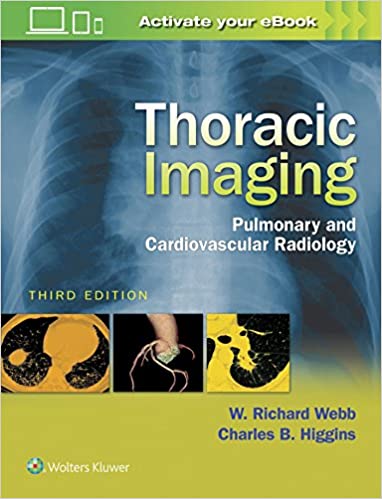 Thoracic Imaging: Pulmonary and Cardiovascular Radiology 3rd Edition [ EPUB + CONVERTED PDF]