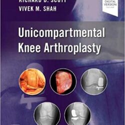 Unicompartmental Knee Arthroplasty 1st Edition