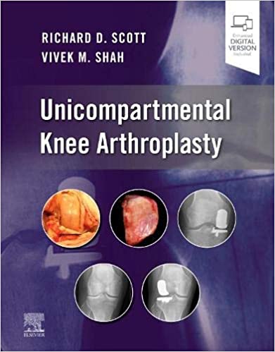 Unicompartmental Knee Arthroplasty (1e/first ed)1st Edition