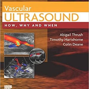 Vascular Ultrasound: How, Why and When 4th Edition