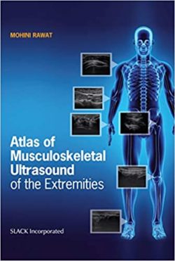 Atlas of Musculoskeletal Ultrasound of the Extremities 1st Edition