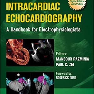 Intracardiac Echocardiography: A Handbook for Electrophysiologists