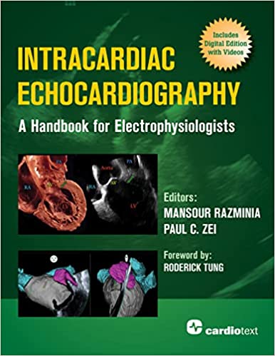 Intracardiac Echocardiography A Handbook for Electrophysiologists ORIGINAL PDF
