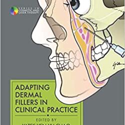 Адаптация дермальных наполнителей в клинической практике (серия по косметической и лазерной терапии)