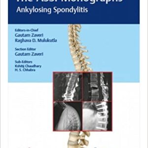 The ASSI (Association of Spine Surgeons of India) Monograph Series: Ankylosing Spondylitis