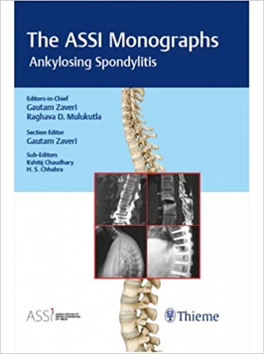 The ASSI (Association of Spine Surgeons of India) Monograph Series: Ankylosing Spondylitis