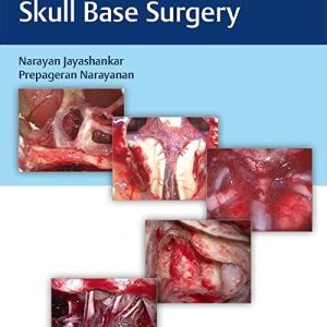 Atlas of 360 Degree Skull Base Surgery (360°)