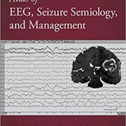 Atlas of EEG, Seizure Semiology, and Management (3rd Ed/3E) THIRD Edition