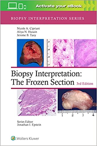Biopsy Interpretation: The Frozen Section (Biopsy Interpretation Series Frozen Section 3rd Ed/3e) Third Edition