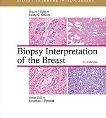 Biopsy Interpretation of the Breast PDF (Biopsy Interpretation Series 3e. THIRD ed) 3rd Edition