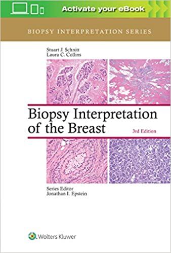 Biopsy Interpretation of the Breast PDF (Biopsy Interpretation Series 3e. THIRD ed) 3rd Edition