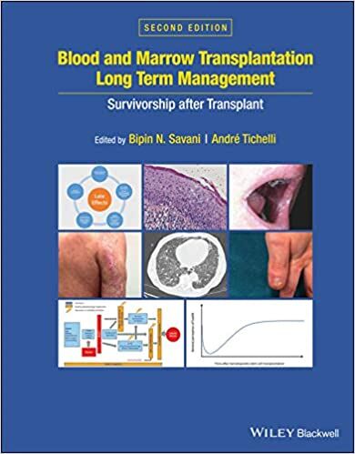 Blood and Marrow Transplantation Long Term Management Survivorship after Transplant 2nd Edition