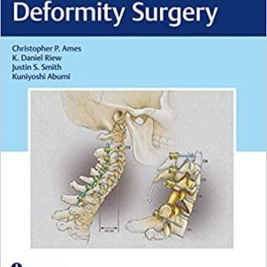 Cervical Spine Deformity Surgery [PDF 1st ed/1e] First Edition