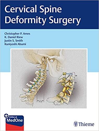 Cervical Spine Deformity Surgery [PDF 1st ed/1e] First Edition