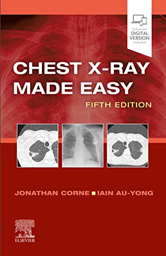 Chest X-Ray Made Easy (5th ed/5e) Fifth Edition
