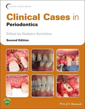 Clinical Cases in Periodontics [PDF 2nd ed/2e] Second Edition