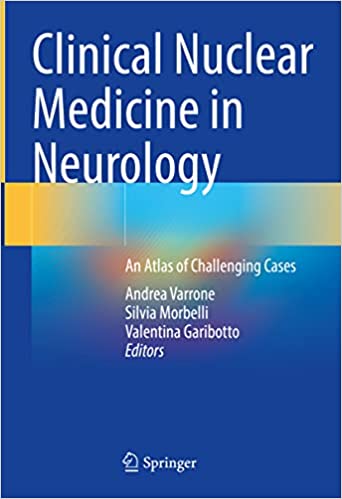 Medicina nuclear clínica en neurología: un atlas de casos desafiantes (1ª ed/1e 2022) Primera edición