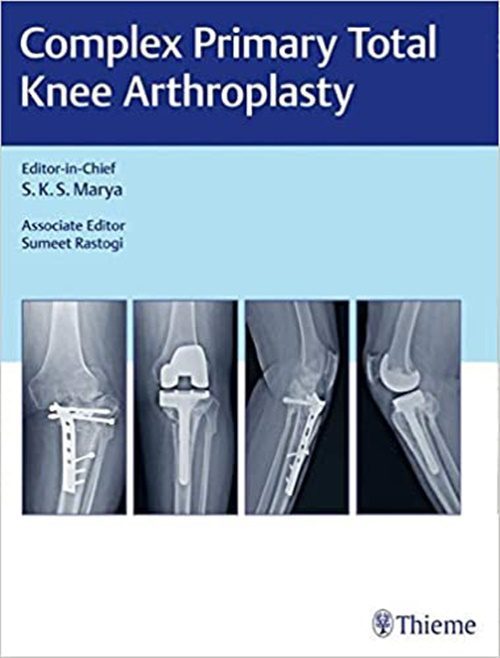 Complex Primary Total Knee Arthroplasty (1st ed/1e) First Edition