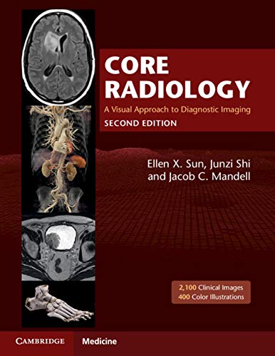 Radiologia di base: un approccio visivo all'imaging diagnostico Seconda edizione