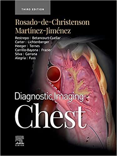 Diagnóstico por imágenes: tórax (3ra ed/3e) Tercera edición