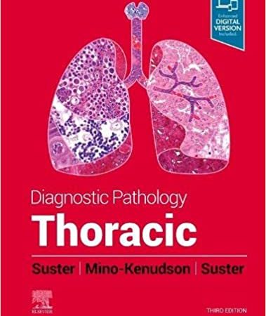 Diagnostic Pathology Thoracic Third Edition