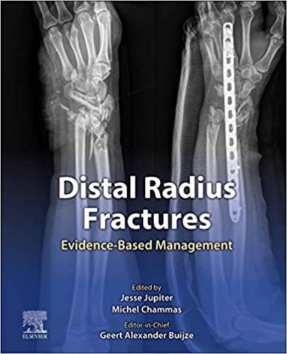 Distal Radius Fractures Evidence Based Management 1st Edition
